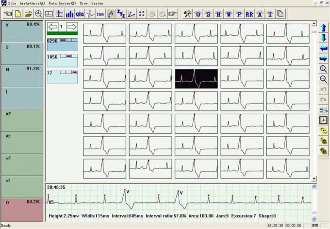 TLC6000 동적인 ECG 체계 12의 지도 ECG Holter 체계 분석 소프트웨어를 가진 기록병 48 시간